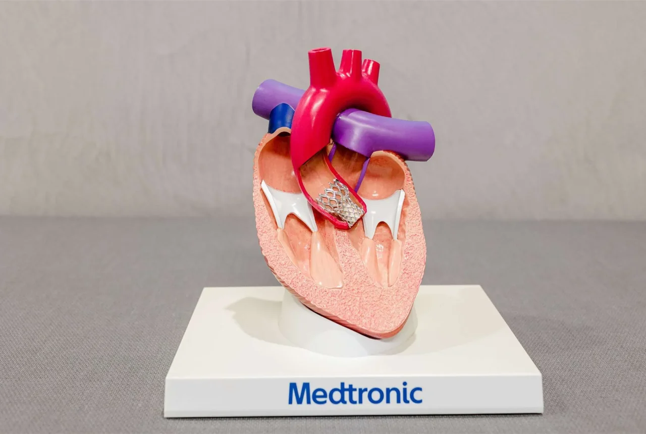 Anatomical model of a human heart