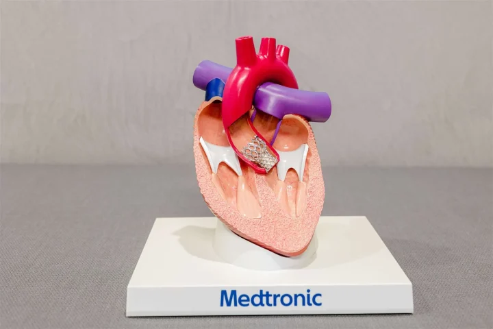 Atrial Septal Defect (ASD) Closure